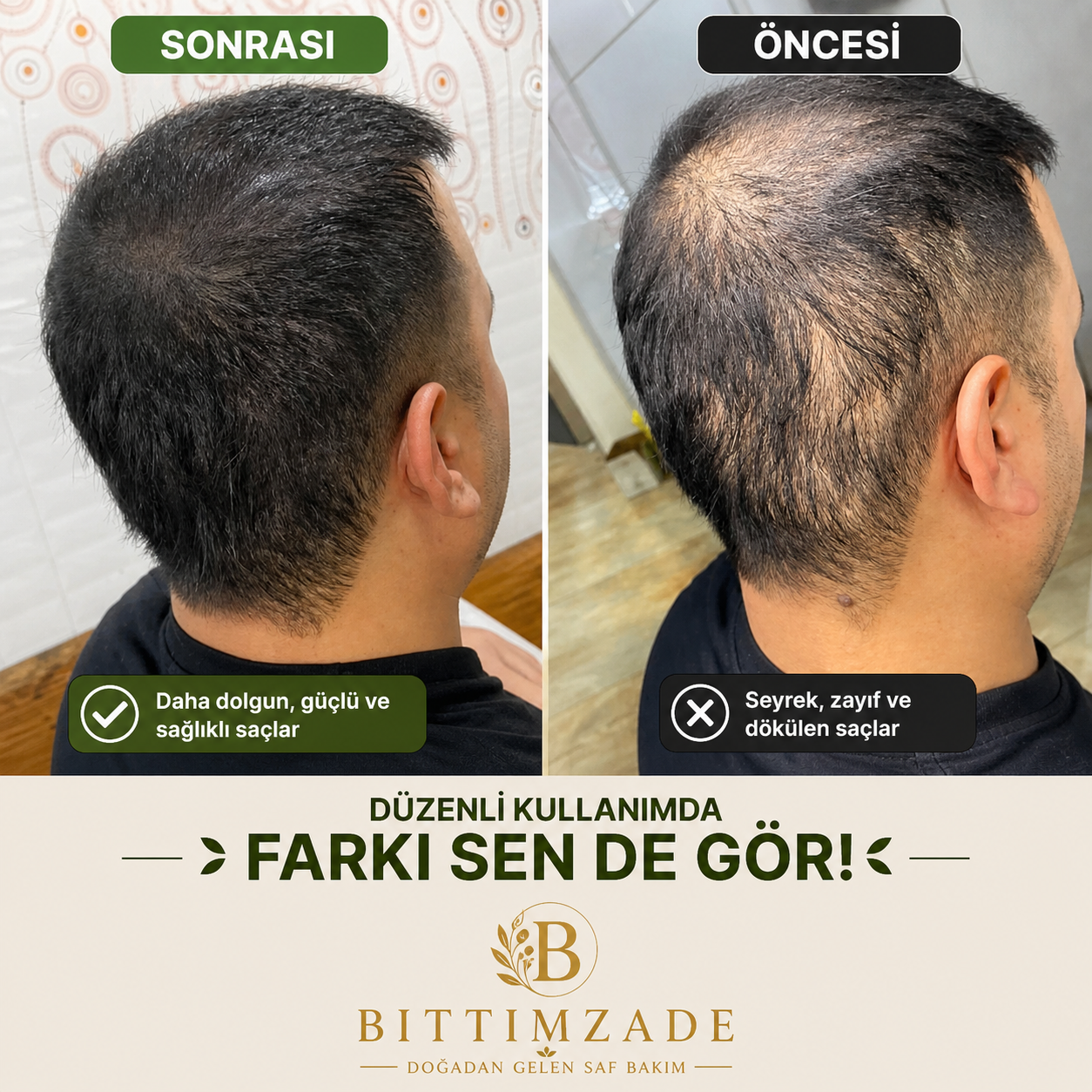 Bıttımzade 3’lü Saç Bakım Seti